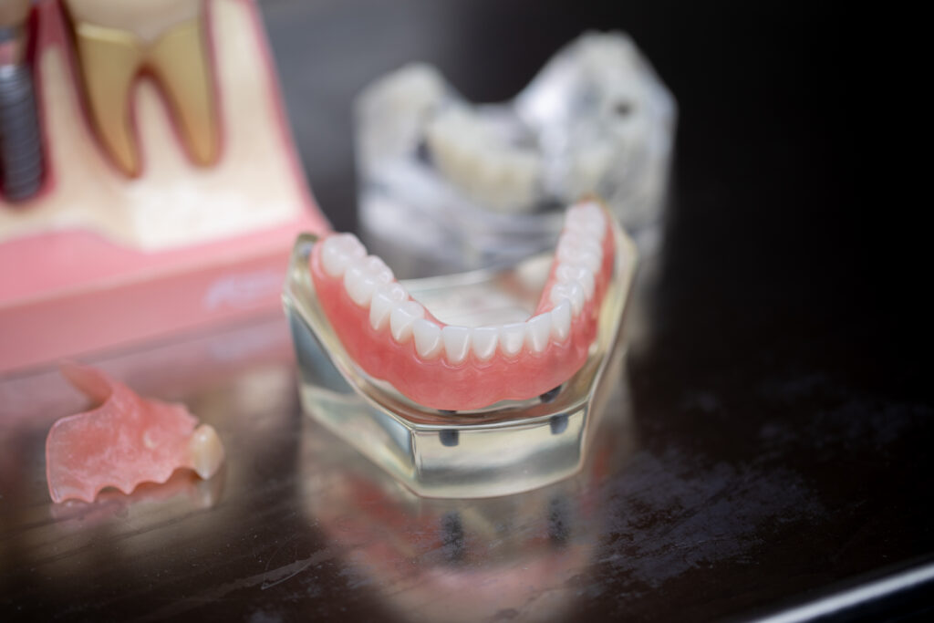 dental models of dentures