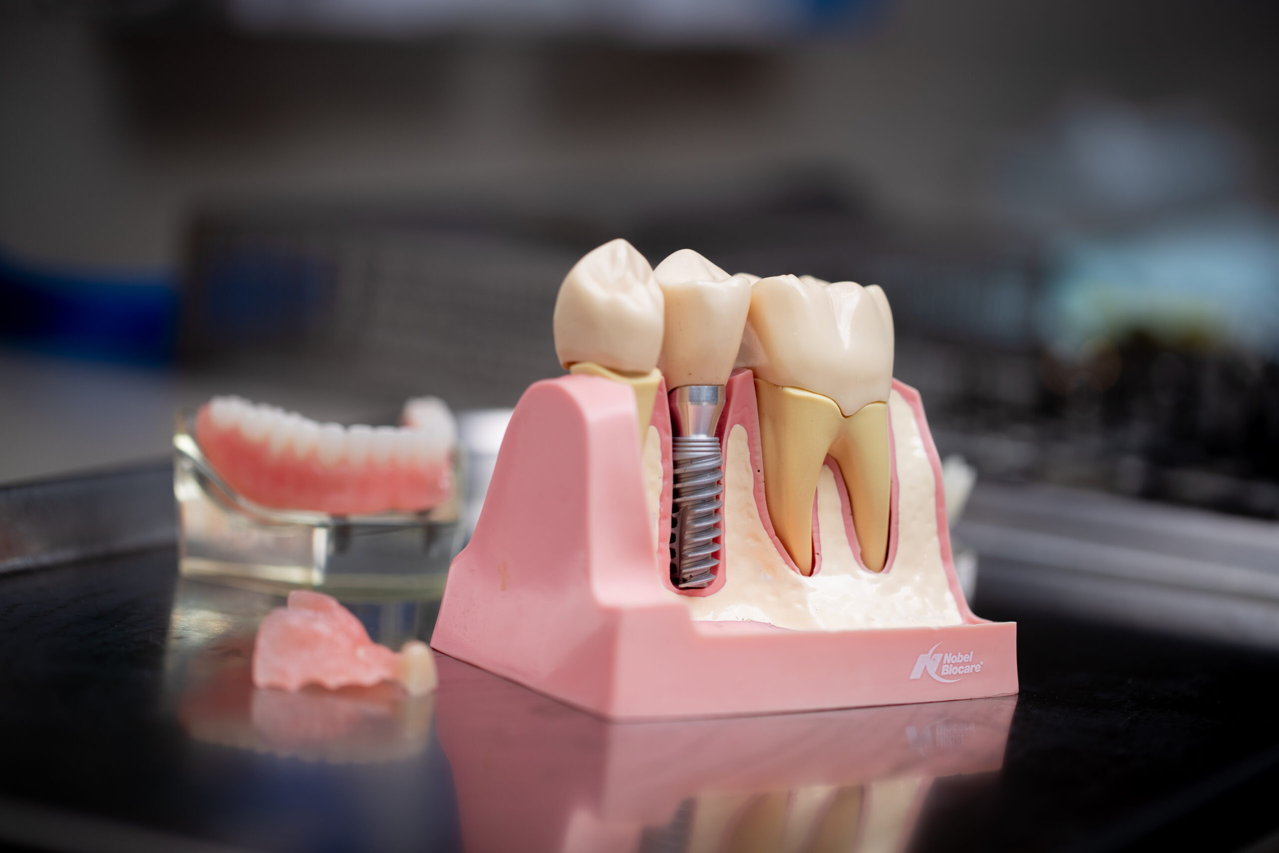 model of dental implant