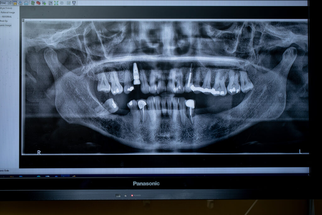 dental x-rays