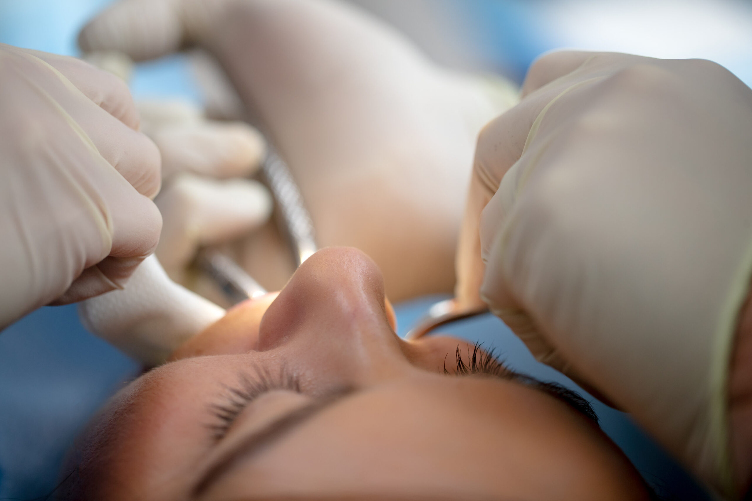 woman having her mouth worked on at Desert Valley Oral Surgery