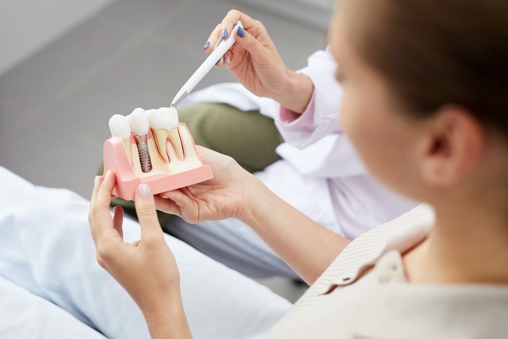 doctor explaining implant placement to a patient holding a model