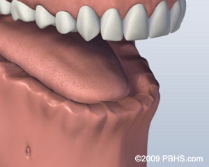 graphic showing missing lower teeth